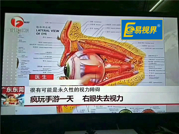 瘋玩手機(jī)一天右眼失去視力_易視界