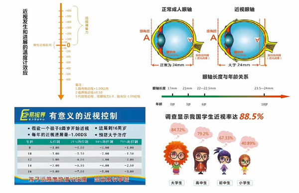 視力下降的原因有哪些【易視界】