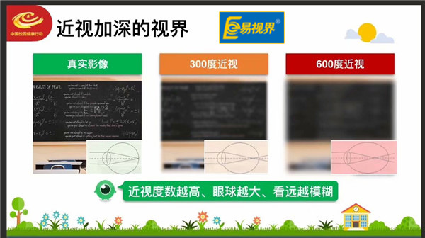 易視界愛眼分享 如何延緩和控制近視度數(shù)的增長