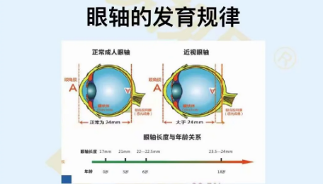 眼軸的發(fā)育規(guī)律