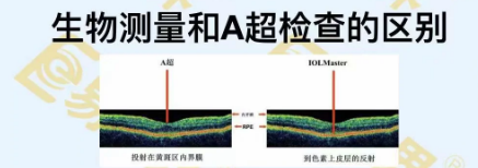 生物測量和A超檢查的區(qū)別