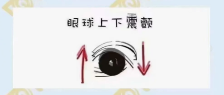 什么是眼球震顫？