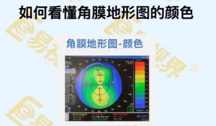 如何看懂角膜地形圖的顏色